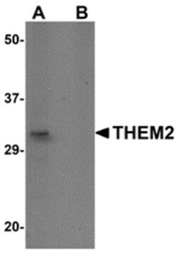 Invitrogen THEM2 Polyclonal Antibody 100 &mu;g; Unconjugated:Antibodies,