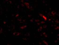 Invitrogen GALNT10 Polyclonal Antibody 100 &mu;g; Unconjugated:Antibodies,