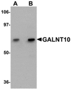 Invitrogen GALNT10 Polyclonal Antibody 100 &mu;g; Unconjugated:Antibodies,