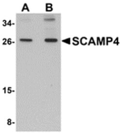 Invitrogen SCAMP4 Polyclonal Antibody 100 &mu;g; Unconjugated:Antibodies,