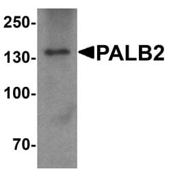Invitrogen PALB2 Polyclonal Antibody 100 μg; Unconjugated:Antibodies,