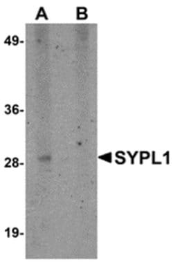 Invitrogen SYPL1 Polyclonal Antibody 100 &mu;g | Buy Online | Invitrogen&trade; | Fisher Scientific