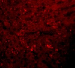 Invitrogen JMJD1A Polyclonal Antibody 100 &mu;g; Unconjugated:Antibodies,
