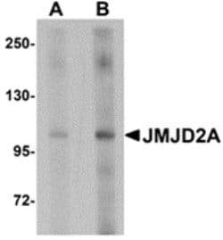 Invitrogen JMJD2A Polyclonal Antibody 100 &mu;g; Unconjugated:Antibodies