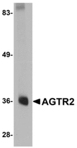 Invitrogen AGTR2 Polyclonal Antibody 100 &mu;g | Buy Online | Invitrogen&trade; | Fisher Scientific