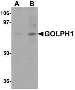 Invitrogen ACBD3 Polyclonal Antibody 100 &mu;g; Unconjugated:Antibodies,