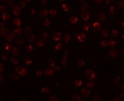Invitrogen NDUFAF2 Polyclonal Antibody 100 &mu;g; Unconjugated:Antibodies,