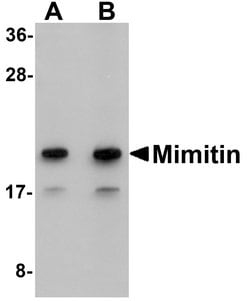 Invitrogen NDUFAF2 Polyclonal Antibody 100 &mu;g; Unconjugated:Antibodies,