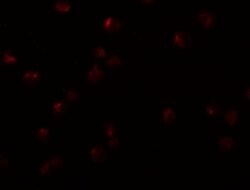 Invitrogen OCIAD2 Polyclonal Antibody 100 μg; Unconjugated:Antibodies,