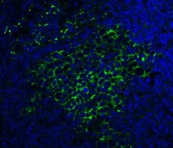 Invitrogen SQSTM1 Polyclonal Antibody 100 μg; Unconjugated:Antibodies,