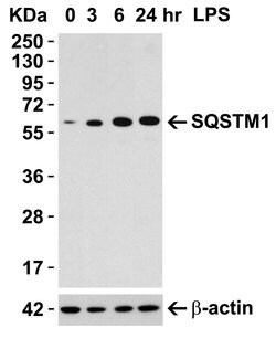 Invitrogen SQSTM1 Polyclonal Antibody 100 μg; Unconjugated:Antibodies,