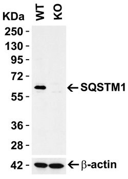 Invitrogen SQSTM1 Polyclonal Antibody 100 μg; Unconjugated:Antibodies,