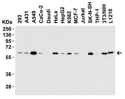 Invitrogen SQSTM1 Polyclonal Antibody 100 μg; Unconjugated:Antibodies,