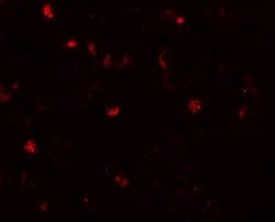 Invitrogen TMEM16B Polyclonal Antibody 100 μg; Unconjugated:Antibodies,