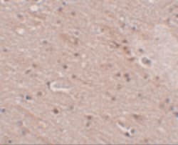 Invitrogen TMEM16B Polyclonal Antibody 100 μg; Unconjugated:Antibodies,