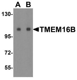 Invitrogen TMEM16B Polyclonal Antibody 100 μg; Unconjugated:Antibodies,