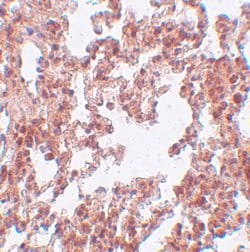 Invitrogen SRPX2 Polyclonal Antibody 100 &mu;g; Unconjugated:Antibodies,