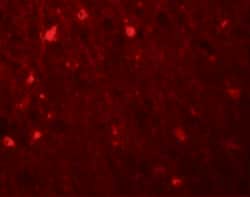 SIPA1L1 Polyclonal Antibody:Antibodies, Polyclonal