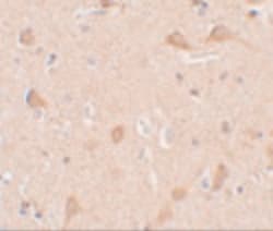 SIPA1L1 Polyclonal Antibody:Antibodies, Polyclonal