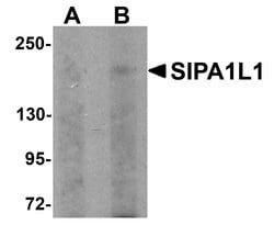 SIPA1L1 Polyclonal Antibody:Antibodies, Polyclonal