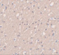 SIPA1L3 Polyclonal Antibody, Invitrogen 100 &mu;g; Unconjugated:Antibodies