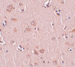 Invitrogen PLEKHM2 Polyclonal Antibody 100 &mu;g | Buy Online | Invitrogen&trade; | Fisher Scientific