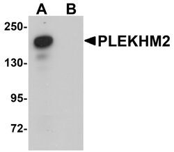 Invitrogen PLEKHM2 Polyclonal Antibody 100 &mu;g | Buy Online | Invitrogen&trade; | Fisher Scientific