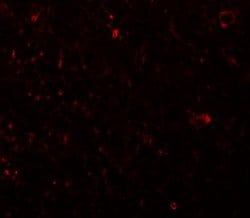 Invitrogen PLEKHM3 Polyclonal Antibody 100 μg; Unconjugated:Antibodies,