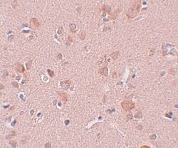 Invitrogen PLEKHM3 Polyclonal Antibody 100 μg; Unconjugated:Antibodies,