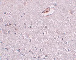 Invitrogen ZNF536 Polyclonal Antibody 100 &mu;g; Unconjugated:Antibodies,