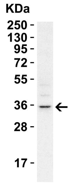 Invitrogen RHBDD1 Polyclonal Antibody 100 &mu;g; Unconjugated:Antibodies,