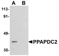 Invitrogen PPAPDC2 Polyclonal Antibody 100 &mu;g; Unconjugated:Antibodies,
