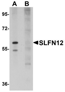 Invitrogen SLFN12 Polyclonal Antibody 100 &mu;g; Unconjugated:Antibodies,