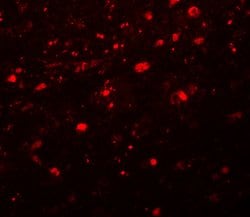 Girdin Polyclonal Antibody:Antibodies, Polyclonal