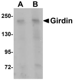 Girdin Polyclonal Antibody:Antibodies, Polyclonal