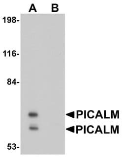 Invitrogen CALM Polyclonal Antibody 100 &mu;g; Unconjugated:Antibodies,