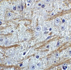 Invitrogen PRDM16 Polyclonal Antibody 100 &mu;g; Unconjugated:Antibodies,