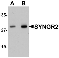 Invitrogen SYNGR2 Polyclonal Antibody 100 &mu;g; Unconjugated:Antibodies,