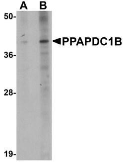 PPAPDC1B Polyclonal Antibody 100 &mu;g | Buy Online | Invitrogen | Fisher Scientific
