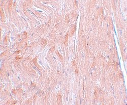 REEP3 Polyclonal Antibody, Invitrogen 100 &mu;g; Unconjugated:Antibodies
