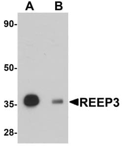 REEP3 Polyclonal Antibody, Invitrogen 100 &mu;g; Unconjugated:Antibodies
