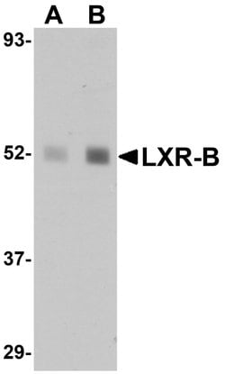 Invitrogen LXR beta Polyclonal Antibody 100 &mu;g; Unconjugated:Antibodies,