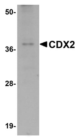 CDX2 Polyclonal Antibody, Invitrogen 100 &mu;g; Unconjugated:Antibodies,