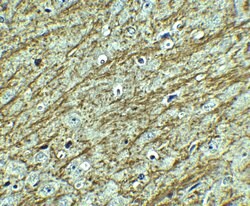 Invitrogen GATA3 Polyclonal Antibody 100 &mu;g; Unconjugated:Antibodies,