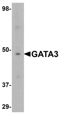 Invitrogen GATA3 Polyclonal Antibody 100 &mu;g; Unconjugated:Antibodies,