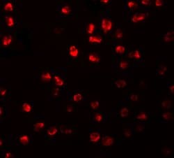 Invitrogen ARHGAP18 Polyclonal Antibody 100 &mu;g; Unconjugated:Antibodies,