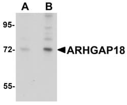 Invitrogen ARHGAP18 Polyclonal Antibody 100 &mu;g; Unconjugated:Antibodies,