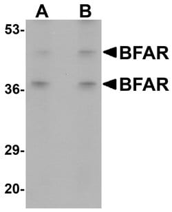Invitrogen BFAR Polyclonal Antibody 100 &mu;g | Buy Online | Invitrogen&trade; | Fisher Scientific