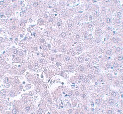 Invitrogen CALHM1 Polyclonal Antibody 100 &mu;g; Unconjugated:Antibodies,