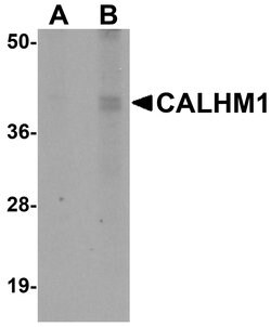 Invitrogen CALHM1 Polyclonal Antibody 100 &mu;g; Unconjugated:Antibodies,